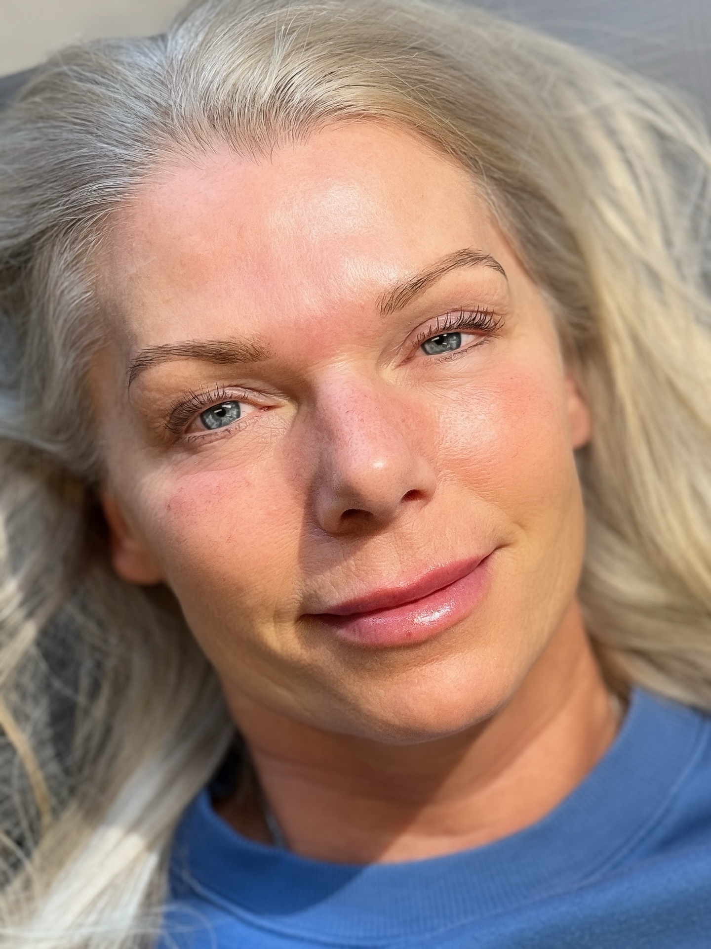 NHT Beauty kundresultat 5